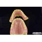 Unleash Potential Of Your Dental Practice Acrylic Denture Finish With Diverse And Lightweight Property for sale