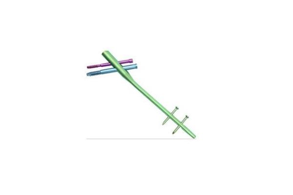 ISO13485 Orthopedic Implants Suprapatellar Tibial Interlocking Nail