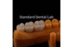 China Be Ni Free Metal Porcelain Crowns Precise Esthetic PFM Crown Dental supplier