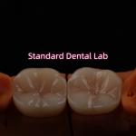 Full Contour Bruxier Monolithic Zirconia Crown Bridge Dental Lab