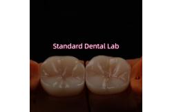China Full Contour Bruxier Monolithic Zirconia Crown Bridge Dental Lab supplier