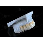 High Translucency Full Contour Zirconia Bridge Chipping Resistance Natural Esthetics
