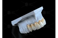 China High Translucency Full Contour Zirconia Bridge Chipping Resistance Natural Esthetics supplier