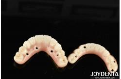 China High Durability Ti-Bar Zirconia Hybrid Bridge For Achieving Aesthetics supplier