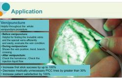 China Injection Light Ems Health Analyzer Machine , Handheld Vein Locating Device supplier
