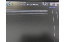 China Samsung L3-12A Ultrasound Probe Transducer Replace Strain Relief Cable And Lense supplier