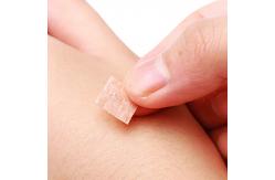 China Ethylene Oxide Gas Sterilization Method Acu Press Needles CE TUV ISO GMP Certification supplier