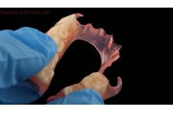 China Dental TCS Valplast Flexible Partial Dentures Dental Lab 3D Print Model High Esthetics supplier
