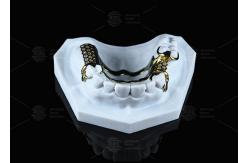 China Corrosion Resistant Printed Titanium Framework Sensitive Skin supplier