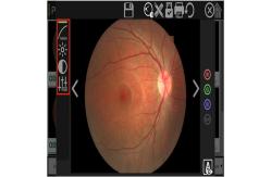 China High Resolution Digital Fundus Camera Red Free Retinal Imaging supplier