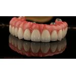 Full Arch Zirconia Implants Bridge Zirconia Crown Vita Shade Customized All On Four / Six Dental Implant for sale