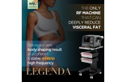 China Skin Lifting Legenda Machine RF Monopolar Machine For Pain Reliveing supplier