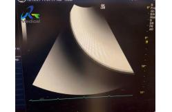 China GE Logiq S6 Ultrasound Machine Repair Displays Virtual Plot And No Echo Zone supplier
