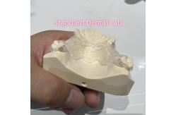 China Removable Cast Clear Framework Partial Easy To Clean And Take Off supplier