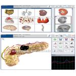 Black Virtual Scanning High Accuracy Metatron Nls 4025 Hunter Body Analyzer Multilanguage