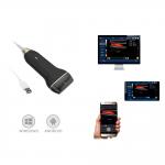 Compact Digital Portable Mobile Ultrasound Scanner Supported Andriod And Window for sale