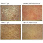 Facial Uv Skin Analyzer Machine For Skin Mositure / Grease / Wrinkle / Pigmentation