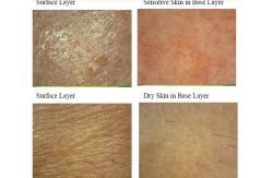 China Facial Uv Skin Analyzer Machine For Skin Mositure / Grease / Wrinkle / Pigmentation supplier