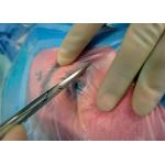 Eye Ophthalmic Sterile Disposable Surgical Drapes Alcohol Resistant With Two Holes And Pouch