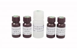 China Male Infertility Sperm Maturity Kit / Sperm Chromatin Structure Assay Kit supplier