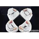 Elaborate Technology Framework Set Up Teeth Finish for Stable Oral Structure for sale