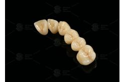 China Strong Aesthetic Porcelain Fused To Zirconia For Natural Looking Restorations supplier