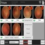Manual Digital Fundus Camera Ophthalmology Coherence Tomography for sale