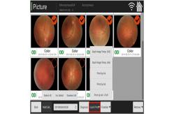 China Manual Digital Fundus Camera Ophthalmology Coherence Tomography supplier
