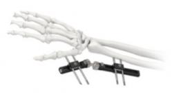 China Orthopedic Wrist External Fixator Standard Single sided Integrated supplier