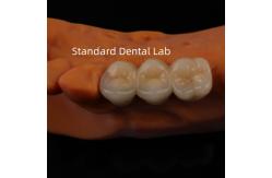 China Digital CAD CAM Dental Lab Crowns Translucent Layered Zirconia Crown supplier