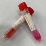 Mixed Disposable Virus Sampling Tube COVID 19 Test Plastic B-12.0 for sale