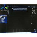GE 7L-RC 12MHz Wide Band Linearx Used Ultrasound Probe Medical Hospital Instrument for sale