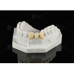 Durable Hypoallergenic EMAX Bridge Extreme Esthetics Emax Dental Bridge