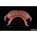 Personalized Invisible Denture Finished With Advanced Tooth Arrangement Technology
