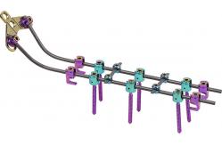 China Spinal Rod System U Multi Axial Pedicle Screw Break Off supplier