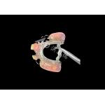 Customizable Fit Cast Partial Dentures for Precision Durability and Comfort in Partial Tooth Replacement for sale
