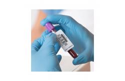 China UV Printing OPP Medication Warning Labels For Blood Collection Tube supplier