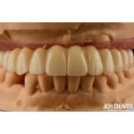 Dental Solution Ti-Base Zirconia Hybrid Bridge High Biocompatibility Natural Looking for sale
