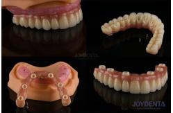 China Dental Multiple Teeth Replacement Implants Rough Surface Prosthetic Components supplier
