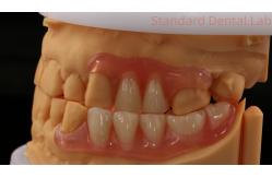 China Dental TCS Valplast Flexible Partial Dentures Dental Lab 3D Print Model High Esthetics supplier