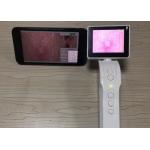 Handheld Digital Dermatoscope Video Dermatoscope Wifi Connection to Mobilephone 3.5 Inch Screen for sale