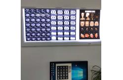 China Laser X Ray Film manufacturer