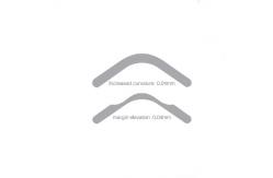 China Single Use Sectional Matrix Band System   Placement supplier