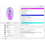 85% Accuracy 8D Nls Body Health Analyzer Advanced Quantum Magnetic Aura Chakra Machine