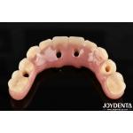 50ml Ti-Bar Acrylic Teeth Finish 24 Hours Curing Time United States For Dental Professionals for sale