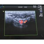 GE Logiq E9 ML6-15-D Breast Ultrasound Probe Repair Linear Vascular Transducer for sale