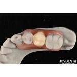 Revolutionize Your Dental Practice  Framework Set Up Teeth Finish With Elaborate Technology From Dental for sale