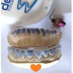 Cosmetic Trushine Thermoforming Foil Tooth Whitening Tray for sale