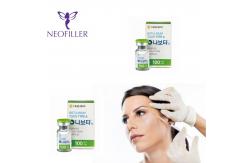 China Korea NABOTA Injection Nabota Toxin 100units Forehead Eyebrow Lines Wrinkles Removal supplier