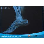 Radiology Blue Inkjet Medical X - ray Film Waterproof Inkjet Printing Film